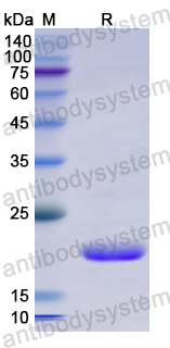 Recombinant Human D2HGDH Protein, N-His