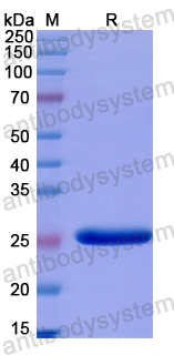 Recombinant Human IGSF1 Protein, N-His
