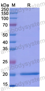 Recombinant Human CD177 Protein, N-His