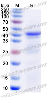 Recombinant Human SIRT6 Protein, N-His