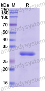 Recombinant Human BMPER Protein, N-His