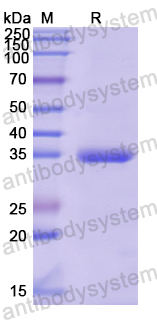 Recombinant Human NAT8L Protein, N-His