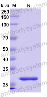 Recombinant Human IL17RC Protein, N-His