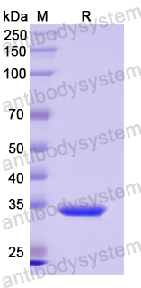 Recombinant Human MLKL Protein, N-His