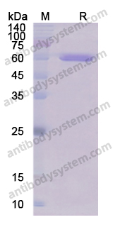 Recombinant Human GOLM1 Protein, N-His