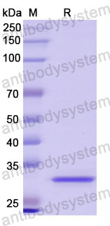 Recombinant Human SUMF1 Protein, N-His