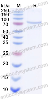 Recombinant Human PCSK9 Protein, N-His