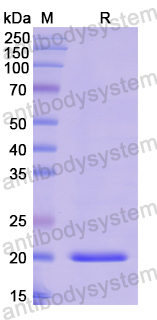 Recombinant Human NAXE Protein, N-His