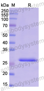 Recombinant Human ABCF1 Protein, N-His