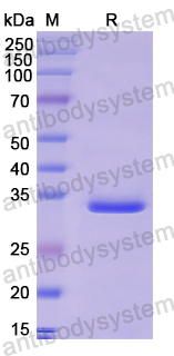 Recombinant Human PIK3C3 Protein, N-His