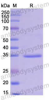 Recombinant Human SHCBP1 Protein, N-His