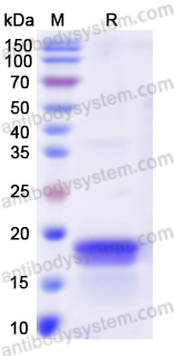 Recombinant Human TRPV3 Protein, N-His