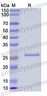 Recombinant Human IL27A/IL30 Protein, N-His