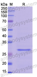 Recombinant Human PRSS33 Protein, N-His