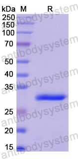 Recombinant Human SYNE1 Protein, N-His