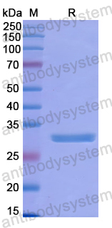 Recombinant Human NUP37 Protein, N-His