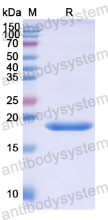 Recombinant Human BEST4 Protein, N-His