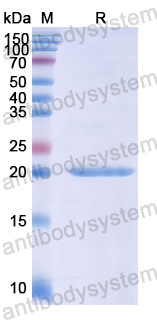 Recombinant Human TNIP2 Protein, N-His
