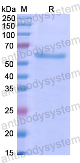 Recombinant Human IL31RA Protein, N-His