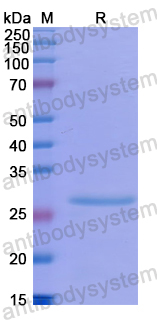 Recombinant Human NFKBID Protein, N-His
