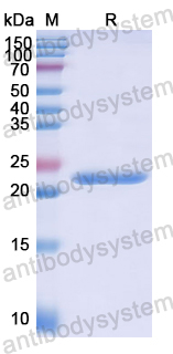 Recombinant Human IL17D Protein, N-His