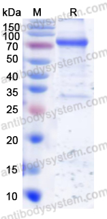 Recombinant Human CIP2A Protein, N-GST