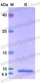 Recombinant Human SP7 Protein, N-His