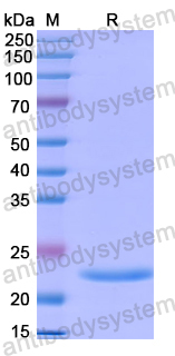 Recombinant Human DLG5 Protein, N-His