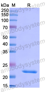 Recombinant Human CD366/HAVCR2/TIM-3 Protein, N-His