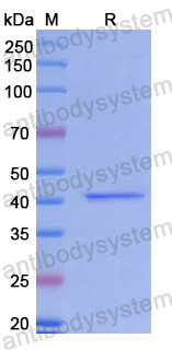 Recombinant Human ADAMTS19 Protein, N-His