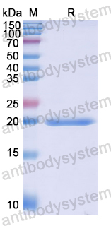 Recombinant Human NUP210 Protein, N-His