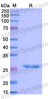 Recombinant Human FRS2 Protein, N-His