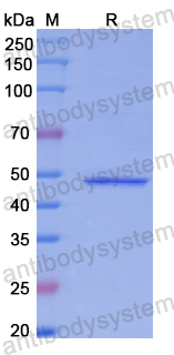 Recombinant Human HDAC7 Protein, N-His