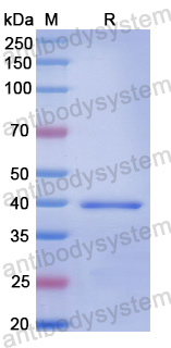 Recombinant Human CEMIP Protein, N-His