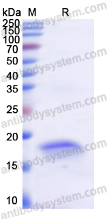 Recombinant Human CEMIP Protein, N-His