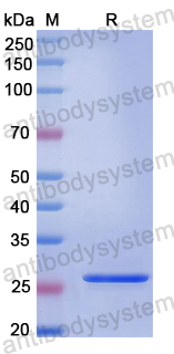 Recombinant Human CEMIP Protein, N-His