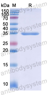 Recombinant Human CANT1 Protein, N-His