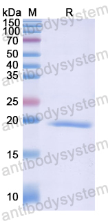 Recombinant Human HMGB4 Protein, N-His