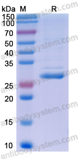 Recombinant Human ITLN1/Omentin Protein, N-His