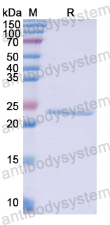 Recombinant Human CYGB Protein, N-His