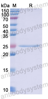 Recombinant Human OIT3 Protein, N-His