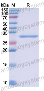 Recombinant Human SYNE2 Protein, N-His