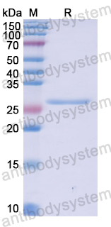 Recombinant Human DNAJC9 Protein, N-His