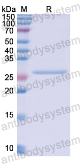 Recombinant Human DDB2 Protein, N-His