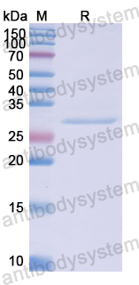 Recombinant Human NCSTN Protein, N-His
