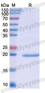 Recombinant Human TSC1 Protein, N-His
