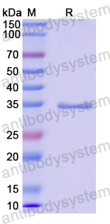 Recombinant Human CCL17/TARC Protein, N-GST