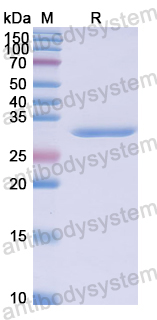 Recombinant Human DOCK2 Protein, N-His