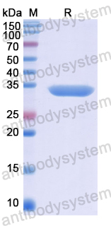 Recombinant Human NUP205 Protein, N-His