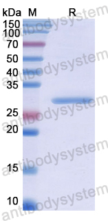 Recombinant Human CENPI Protein, N-His